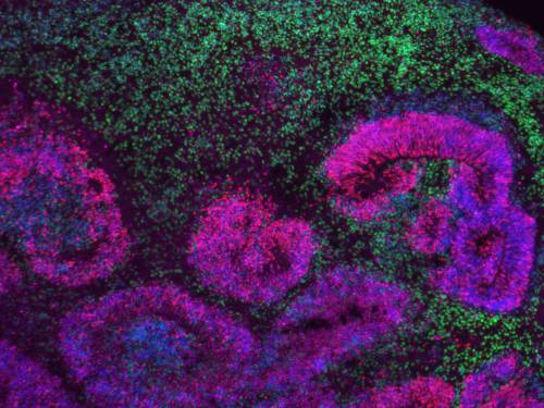 Organoide cortical humano