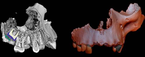 micro-CT de un maxilar fósil de Homo antecessor