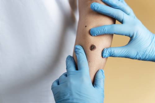 consulta de dermatología