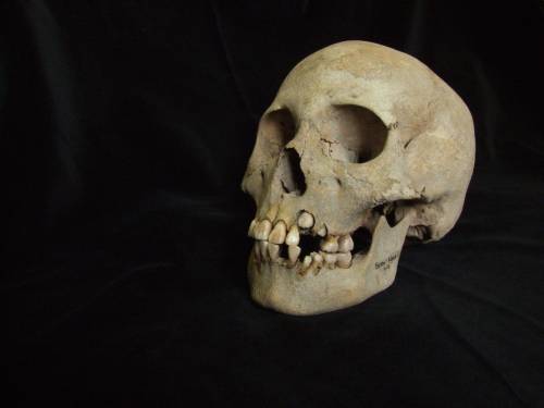 cráneo, peste, Siberia, Prehistoria