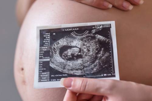 Mujer embarazada sostiene la foto de su bebé