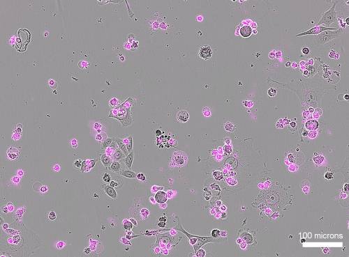 Muerte celular generalizada tras el tratamiento con CRISPR Cas12a2
