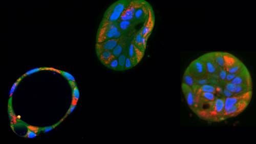 Organoides hepáticos derivados de pacientes y sus mitocondrias