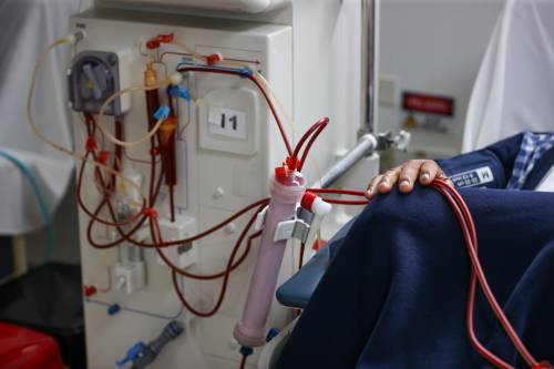 Nueve meses sin diálisis gracias a un riñón de cerdo trasplantado