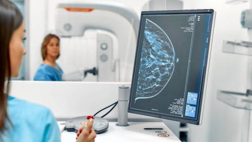 diagnostico mamografía