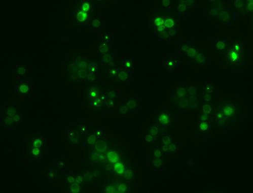 Agregados amiloides, proteínas 
