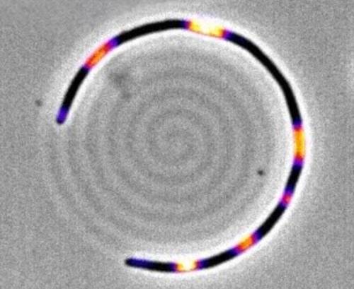 Bacteria de E. coli , resistencia a antibióticos
