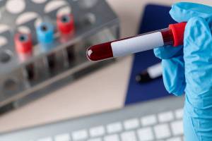 test en sangre, cáncer de páncreas