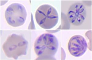 morfología de diversas etapas características del desarrollo de 'Babesia hegotelforum'