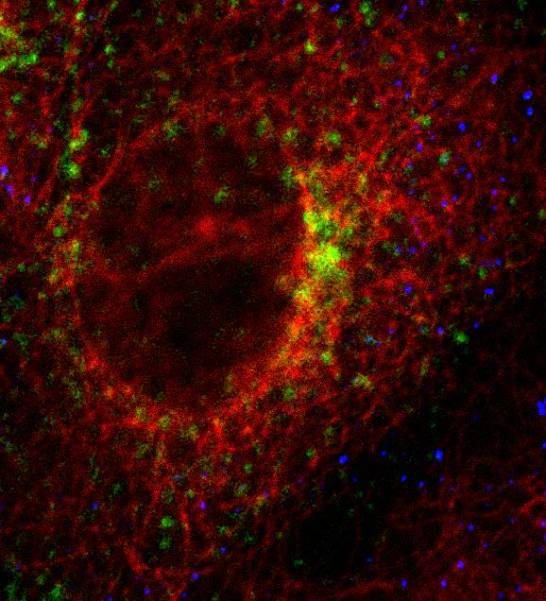 Celulas Infectadas ¿Cómo entran los virus dentro de las células?