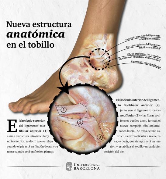 Por Que Los Esguinces De Tobillo Duelen Meses Despues De La Lesion