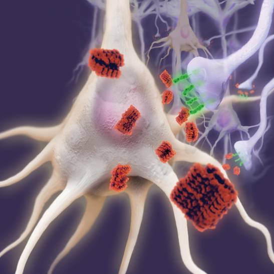Revelado el mecanismo de la proteína beta amiloide que causa alzhéimer en  ratones