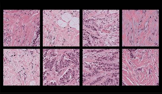 Herramienta de Harvard reduce en 88% sesgos de IA en diagnóstico de cáncer