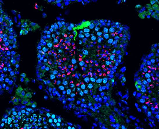 Una terapia con ARNm restaura la fertilidad en ratones con infertilidad genética