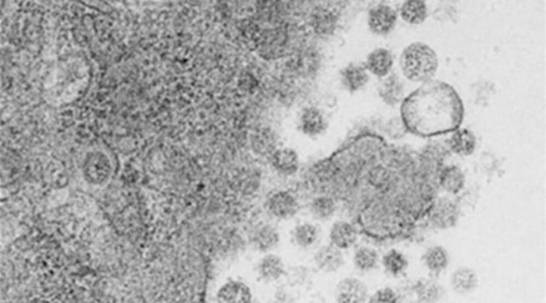 鼻腔内ワクチンは、マウスのCovid-19ウイルスを排除します