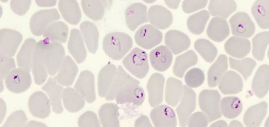 plasmodium bajo microscopio etiquetado
