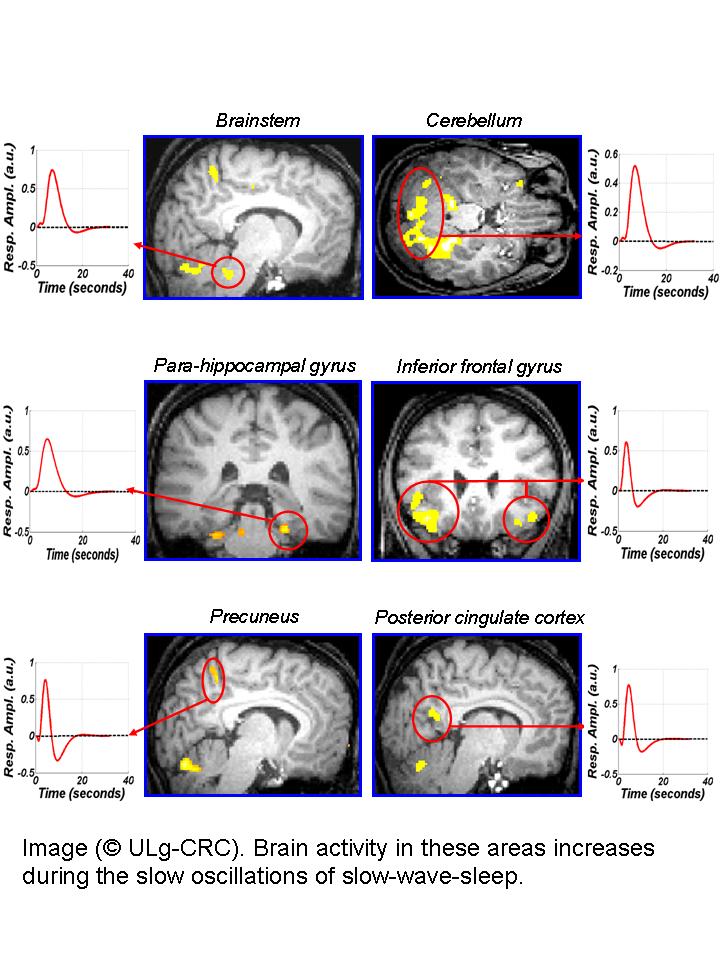 El cerebro sigue despierto incluso durante el sueño profundo