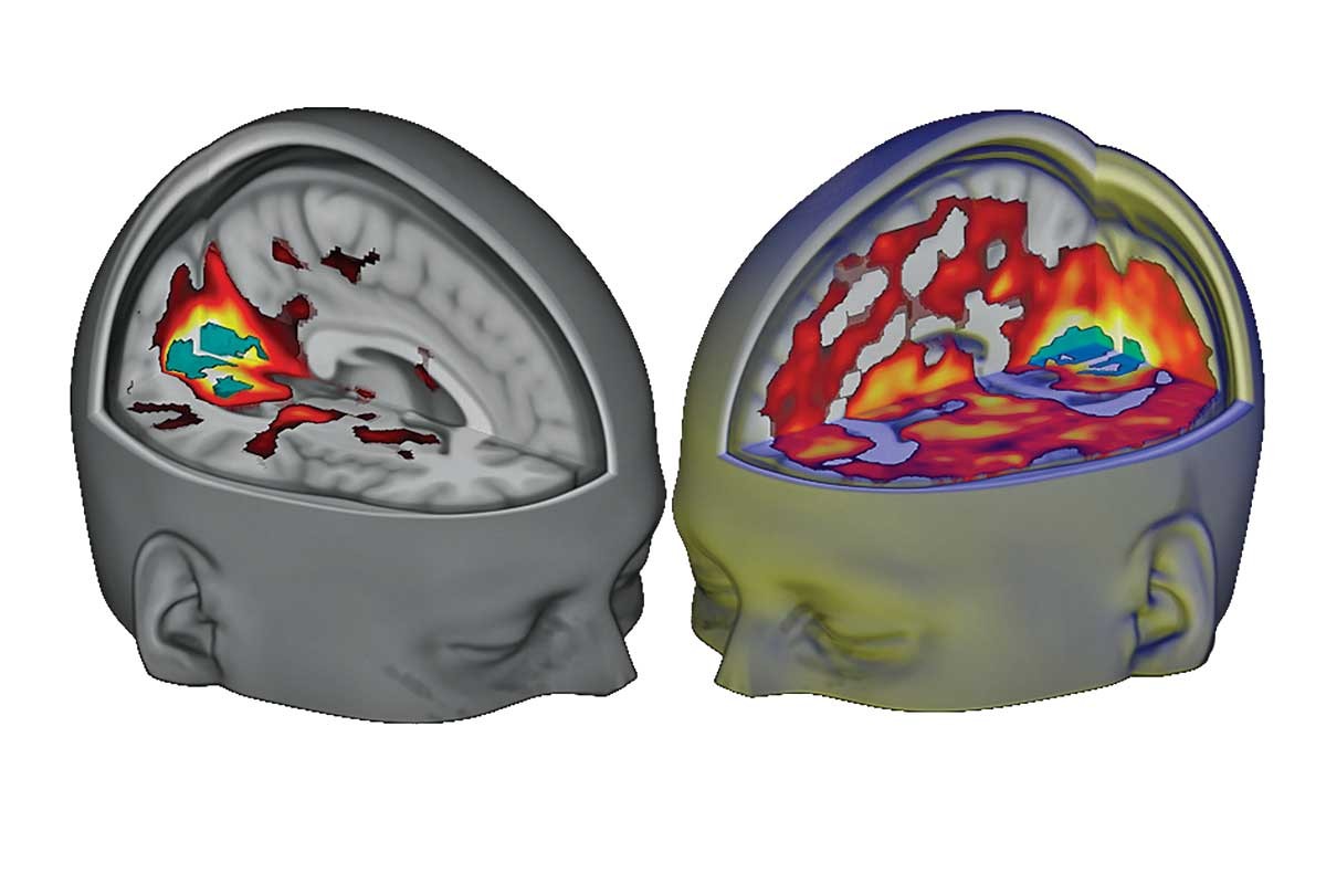 Asi-se-reconecta-el-cerebro-durante-un-viaje-de-LSD.jpg