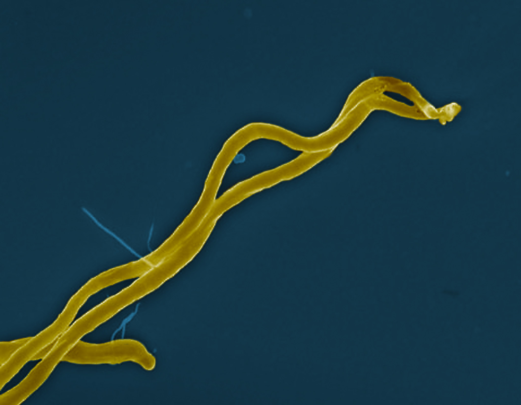 Borrelia burgdorferi