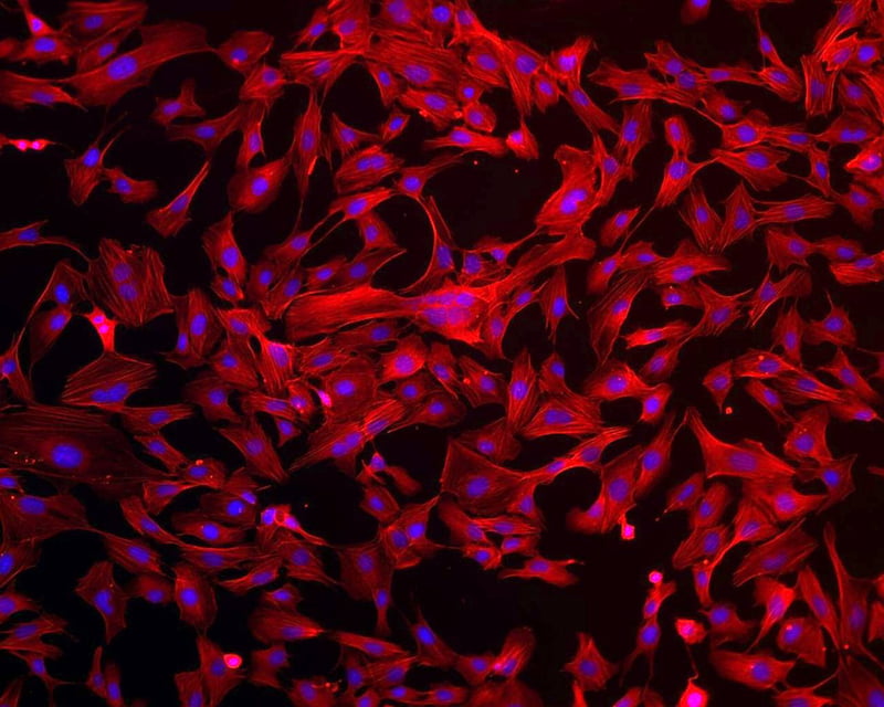 Componentes de células endoteliales humanas teñidas para su identificación. El endotelio, un tejido que recubre las paredes e los vasos sanguíneos, es un protagonista de la evolución de la COVID-19. / ESA