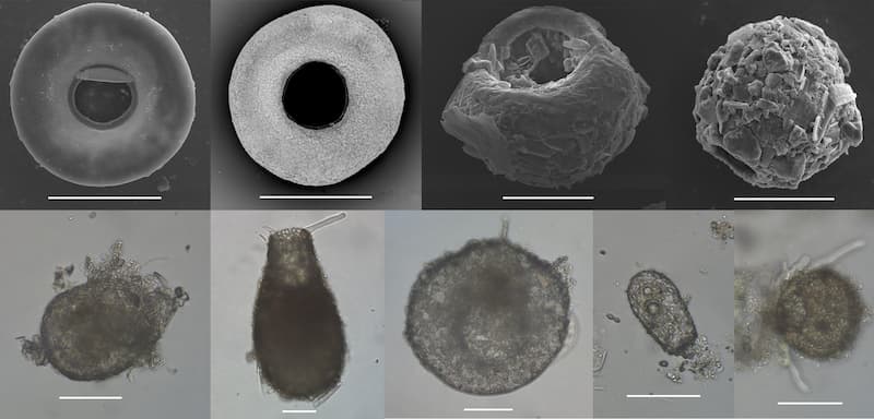 Especies de Arcellinida de lagunas saladas. / CSIC