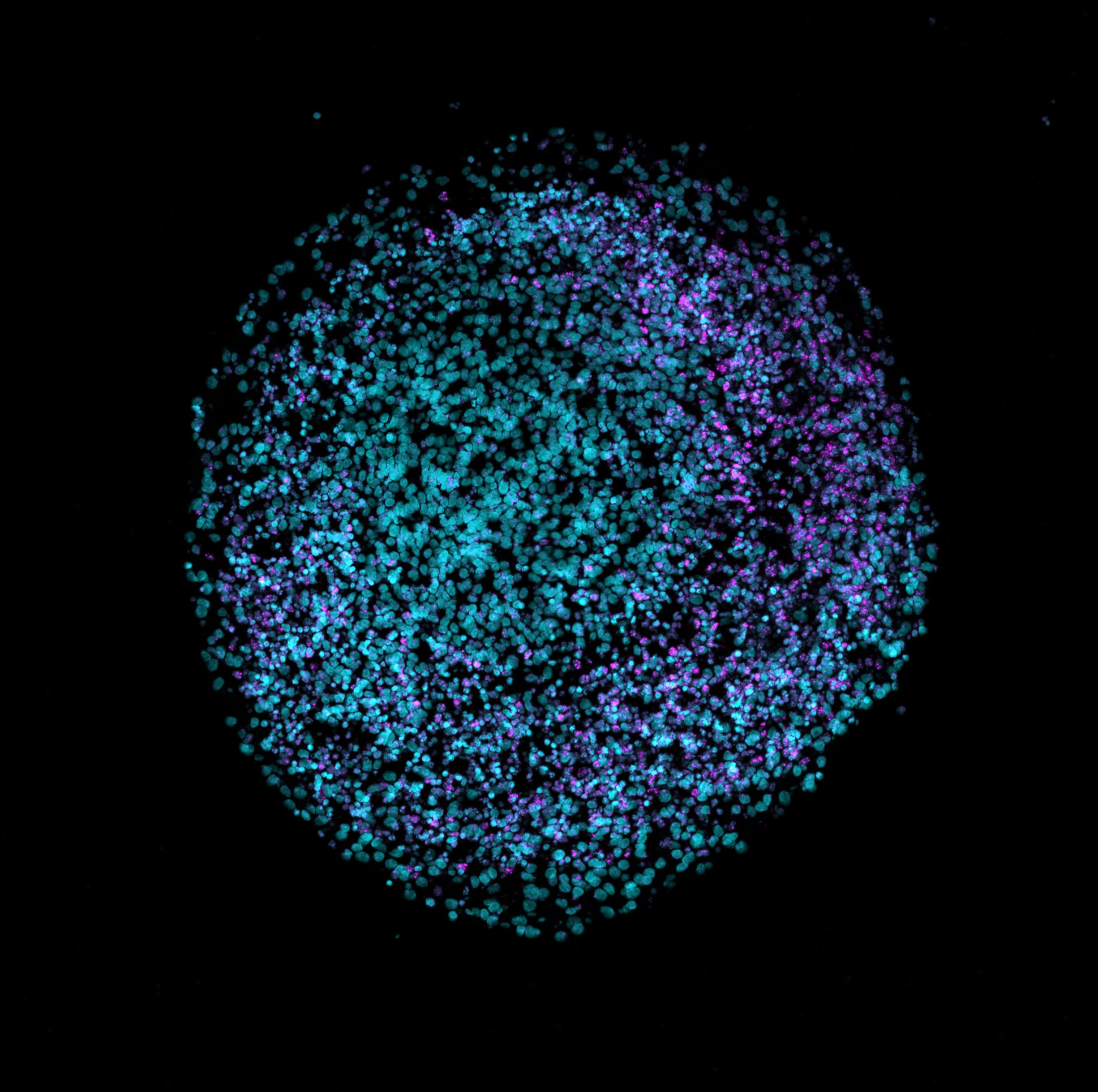 Organoide cerebral