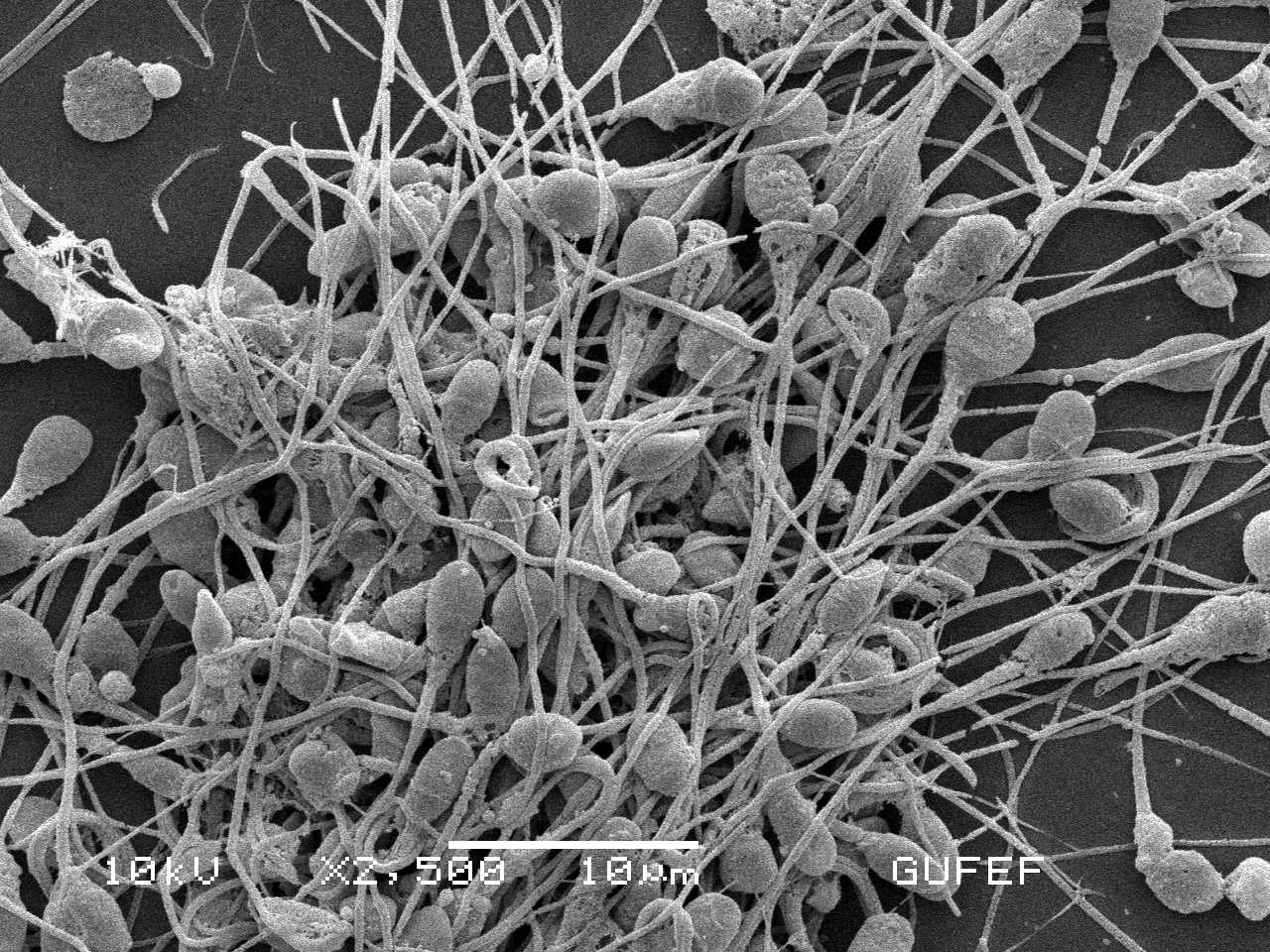 Espermatozoides