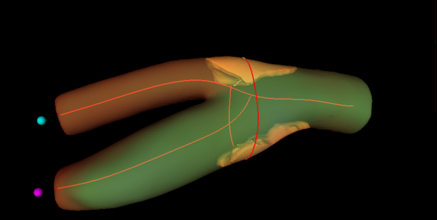 Técnicas de imagen aplicadas en arterias. / CNIC