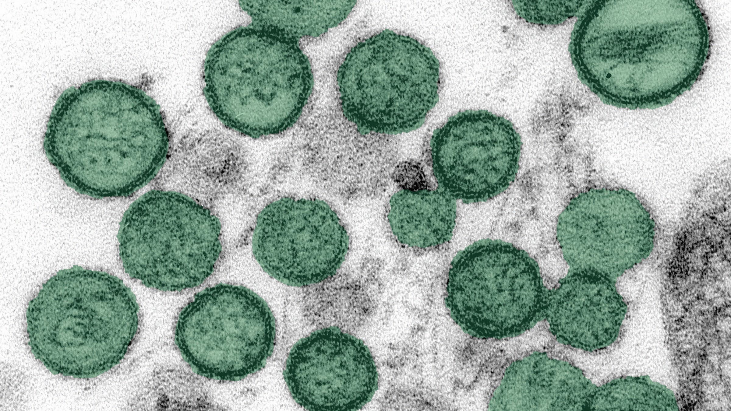 Así escapa el hantavirus al control del sistema inmunitario: ¿cómo puede evitarse?