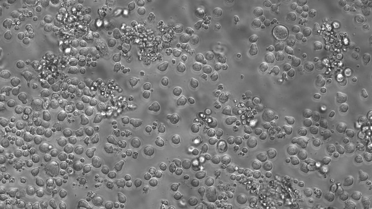 ‘Códigos de barras’ en el ADN revelan cómo envejece la sangre 