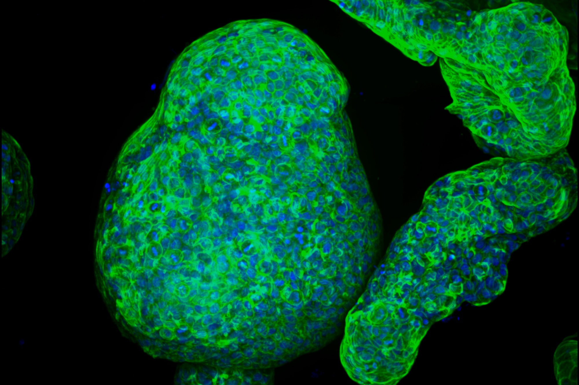 Crean organoides de páncreas ‘cyborg’ capaces de estimular la secreción de insulina