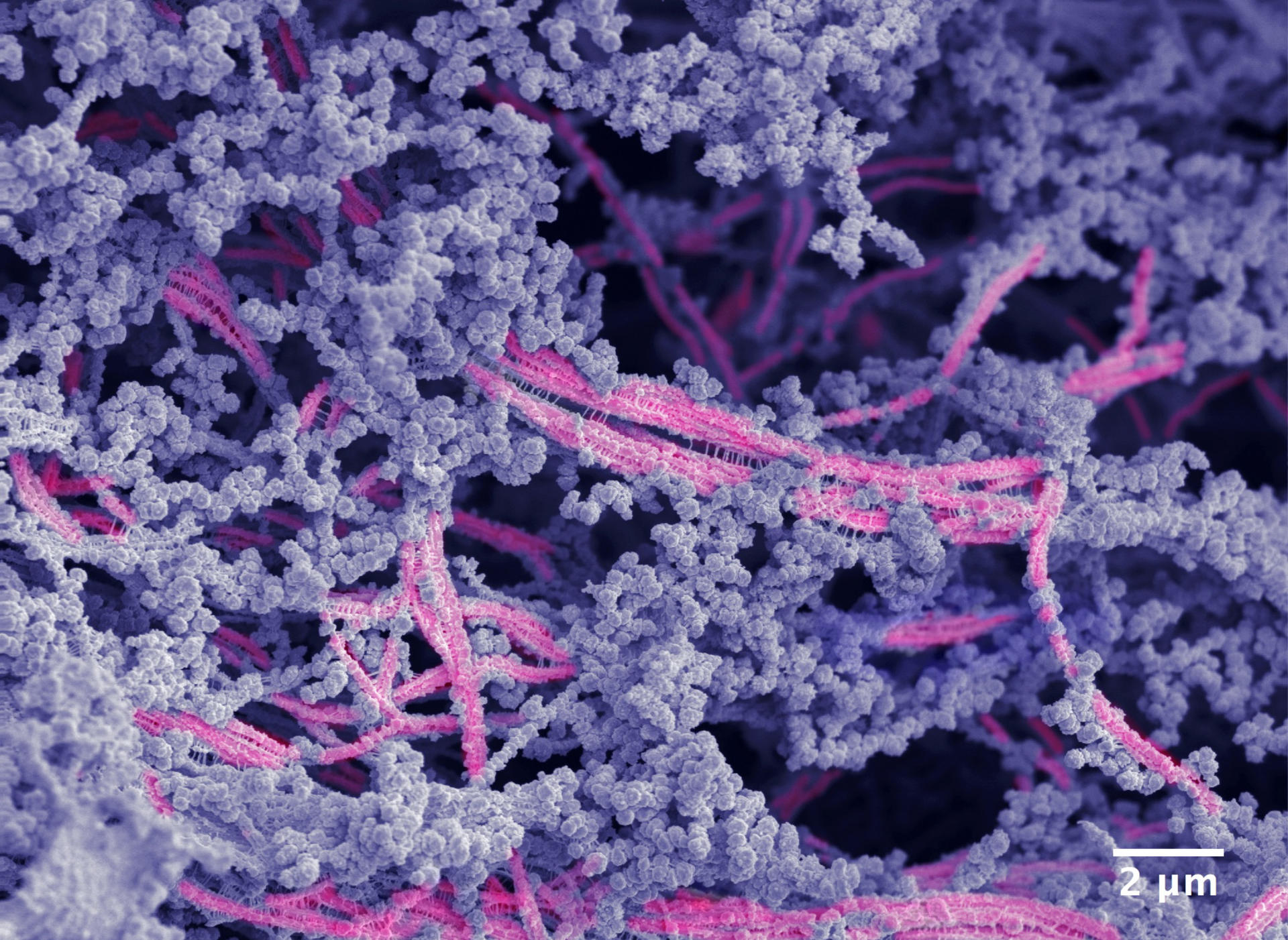 Desarrollan biomaterial que regenera cartílago dañado en las articulaciones