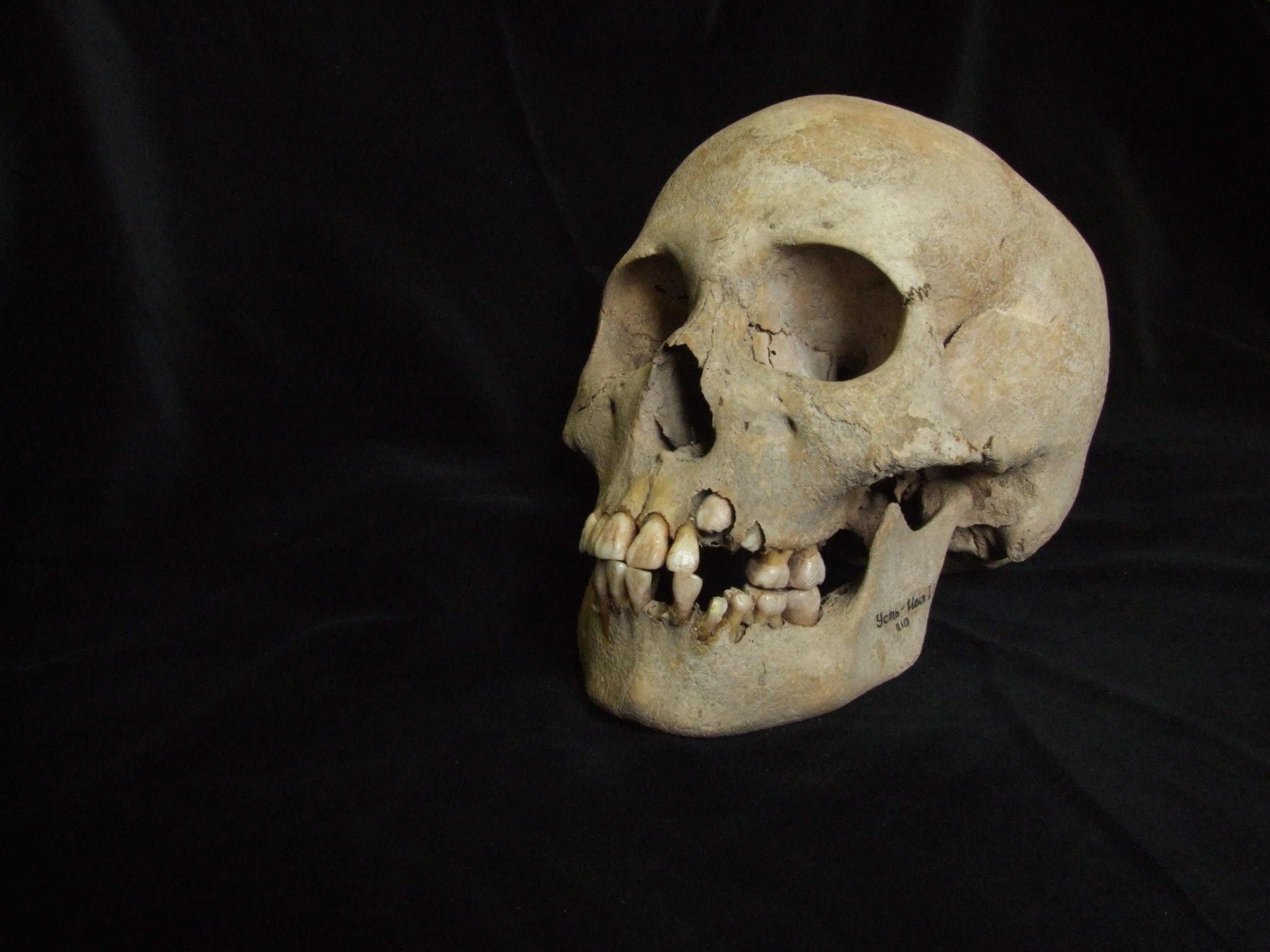 La evidencia más antigua de peste revela brotes letales entre cazadores-recolectores hace 5 500 años