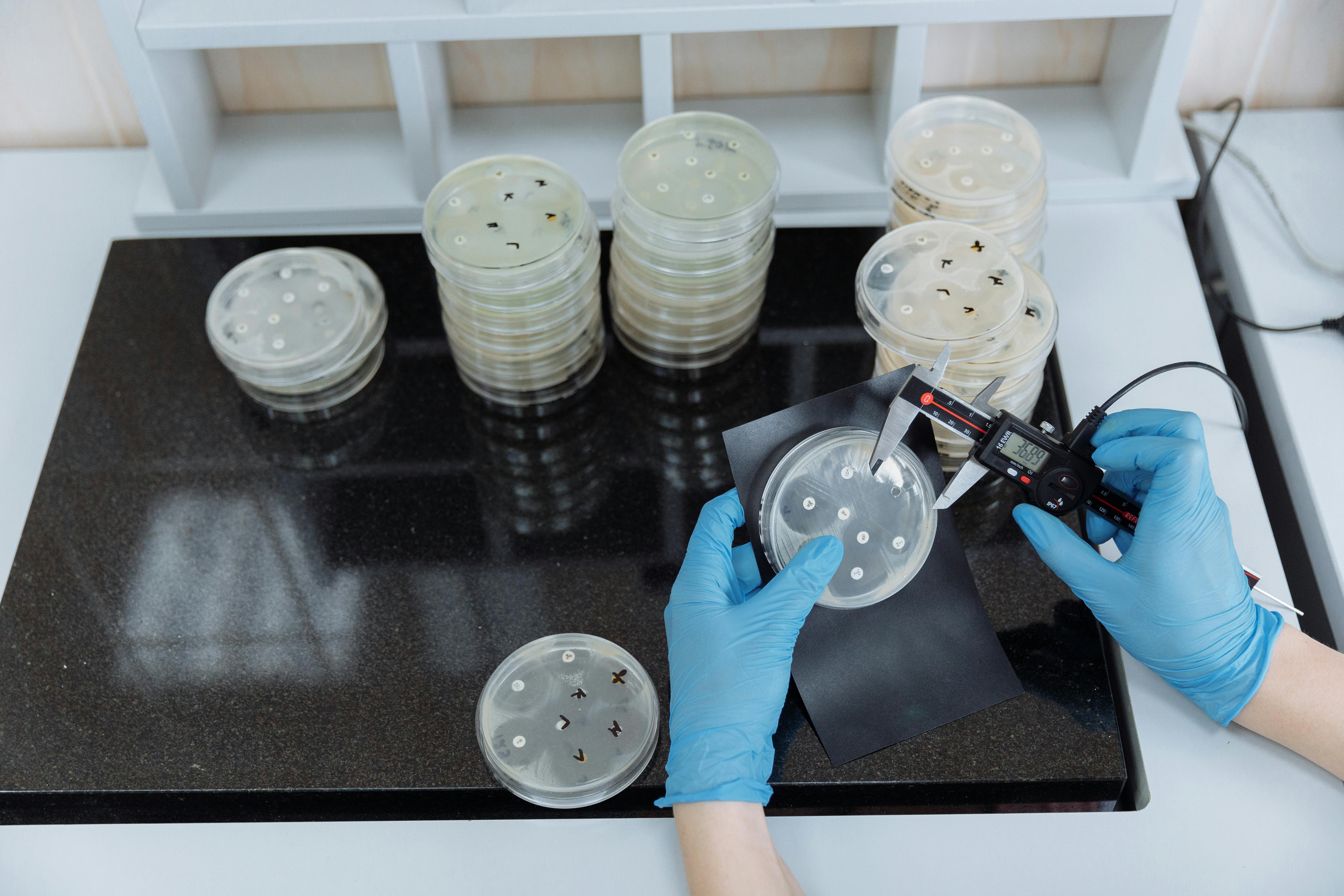 Las bacterias resistentes a los antibióticos ya habitan la fauna silvestre