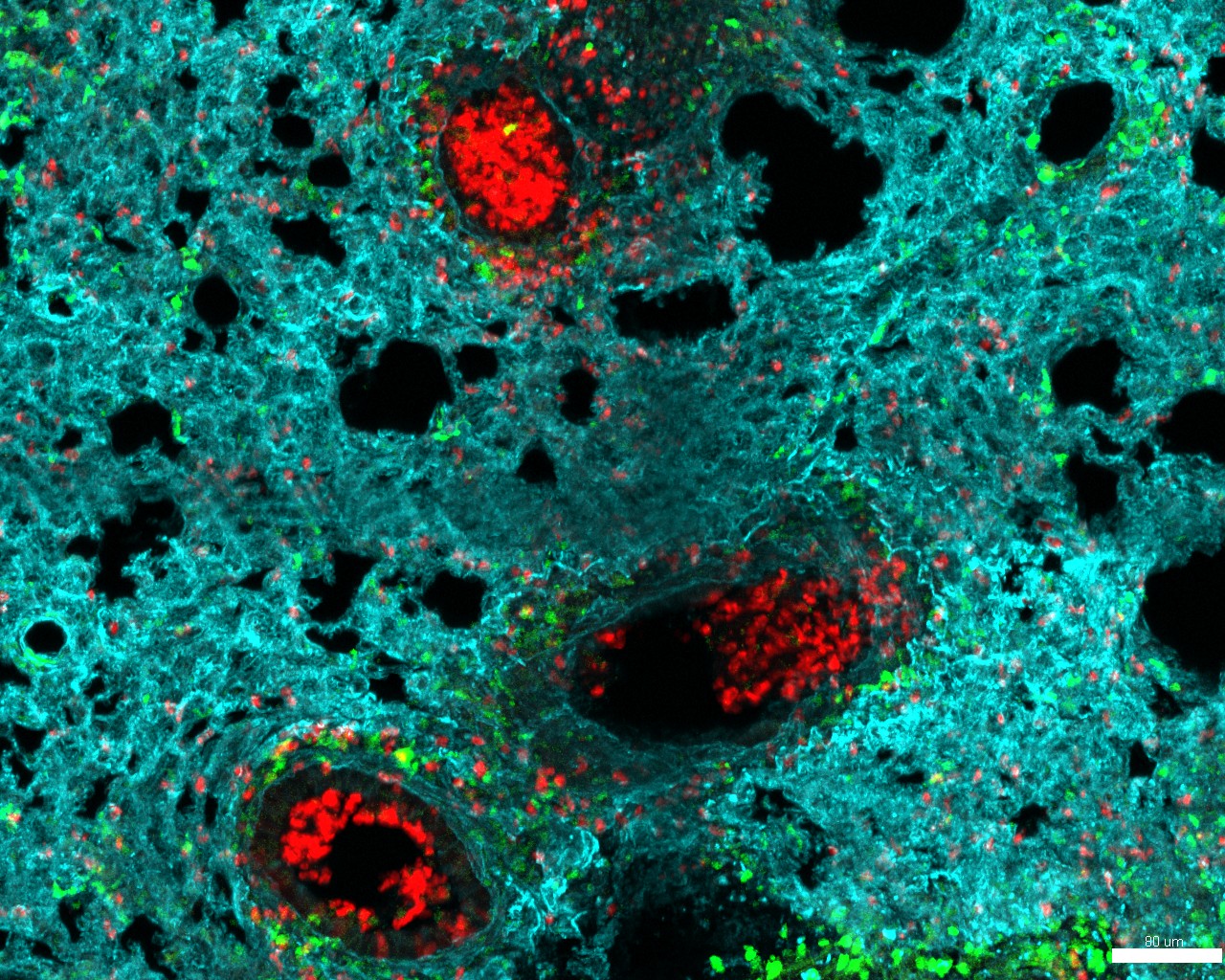NeuMap, un atlas de los neutrófilos que redefine su papel en la salud, infección e inflamación