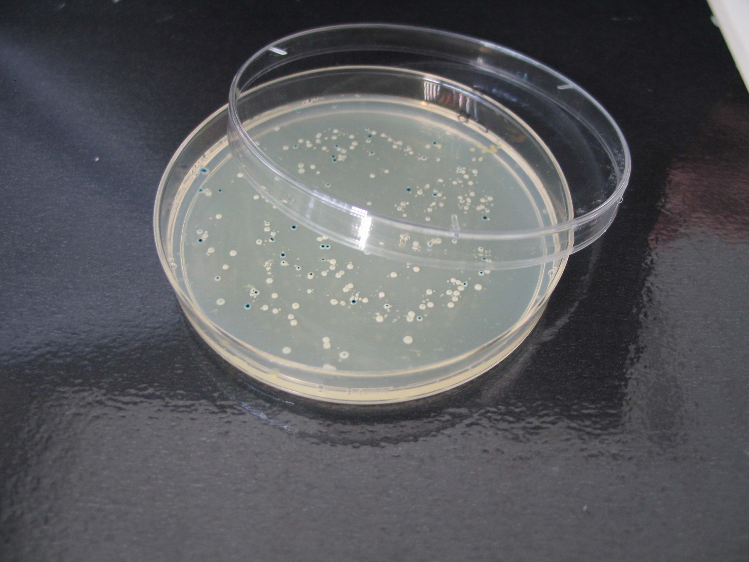 Por qué las bacterias son cada vez más resistentes a los antibióticos