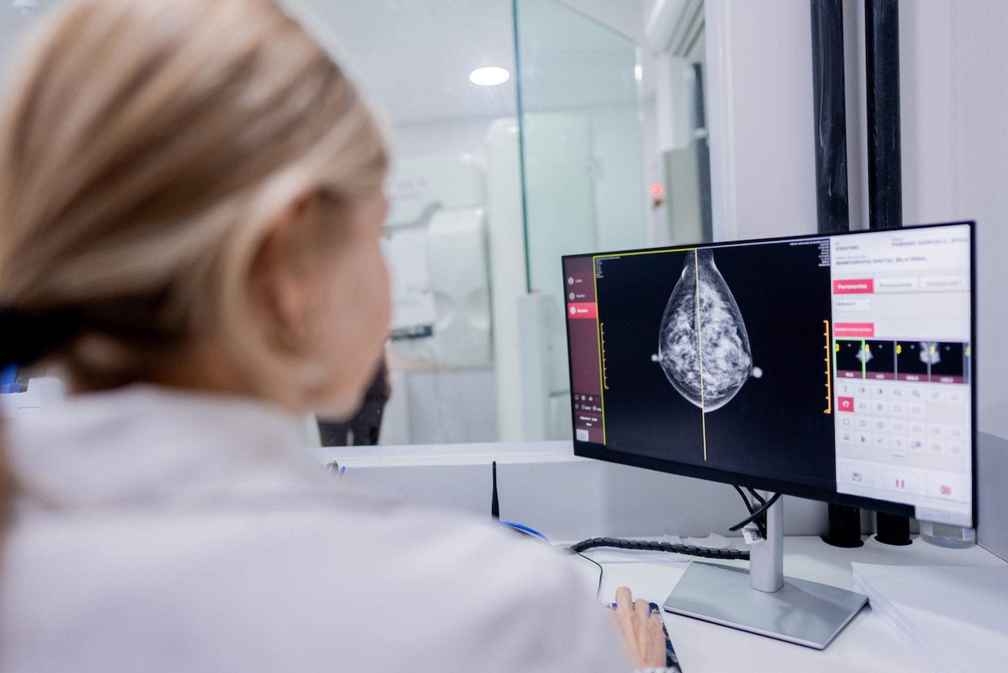 Un fármaco para suprimir la lactancia tras el parto podría reducir el riesgo de cáncer de mama