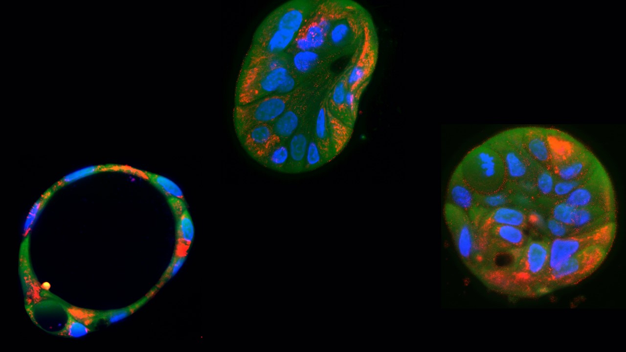 Un nuevo editor genético corrige mutaciones mitocondriales dañinas en células humanas