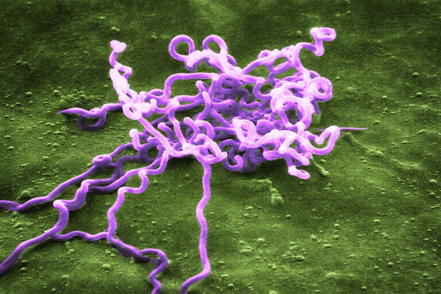 Sífilis: un cazador, una bacteria y el origen profundo de una enfermedad moderna